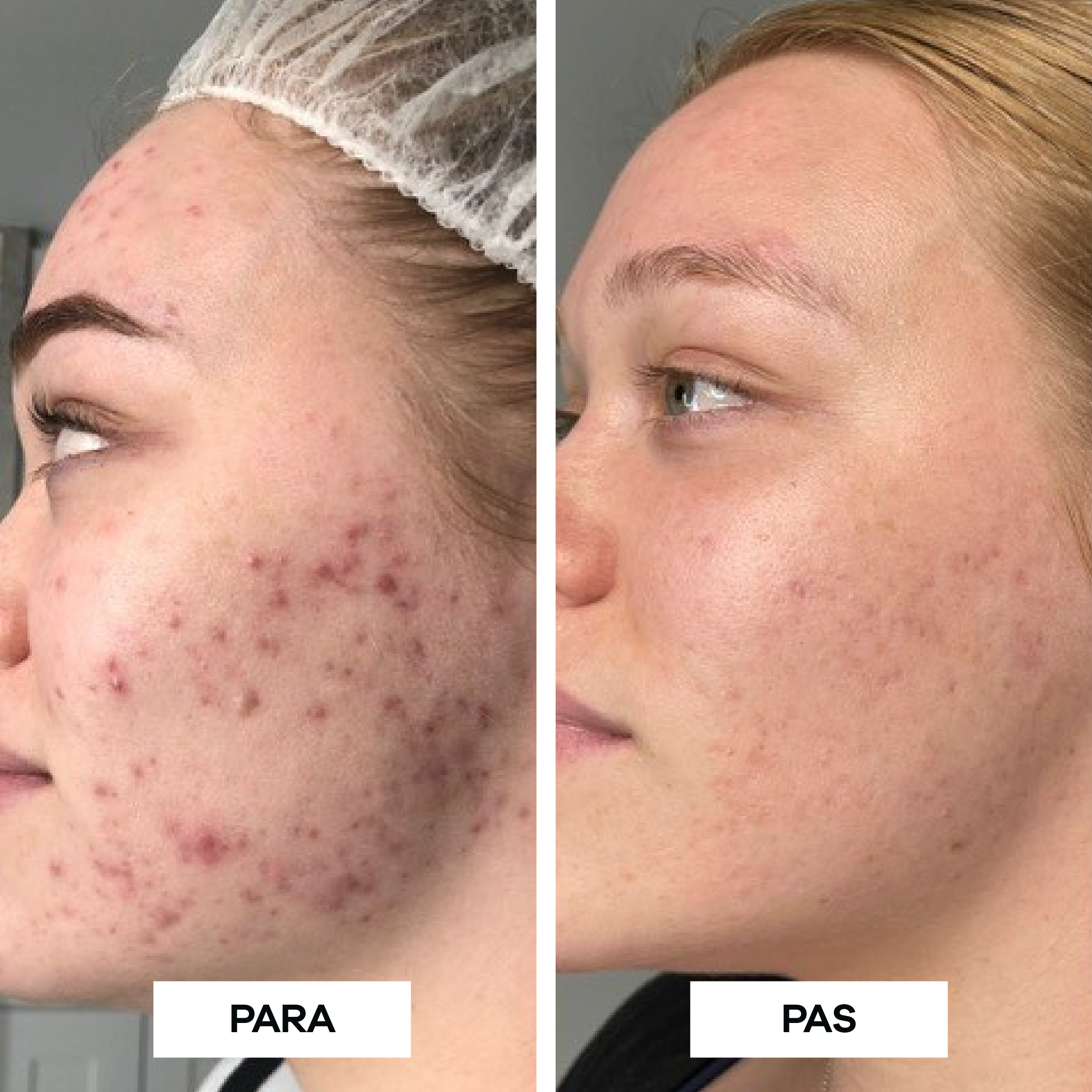 Glowpro Led Mask: Gen2