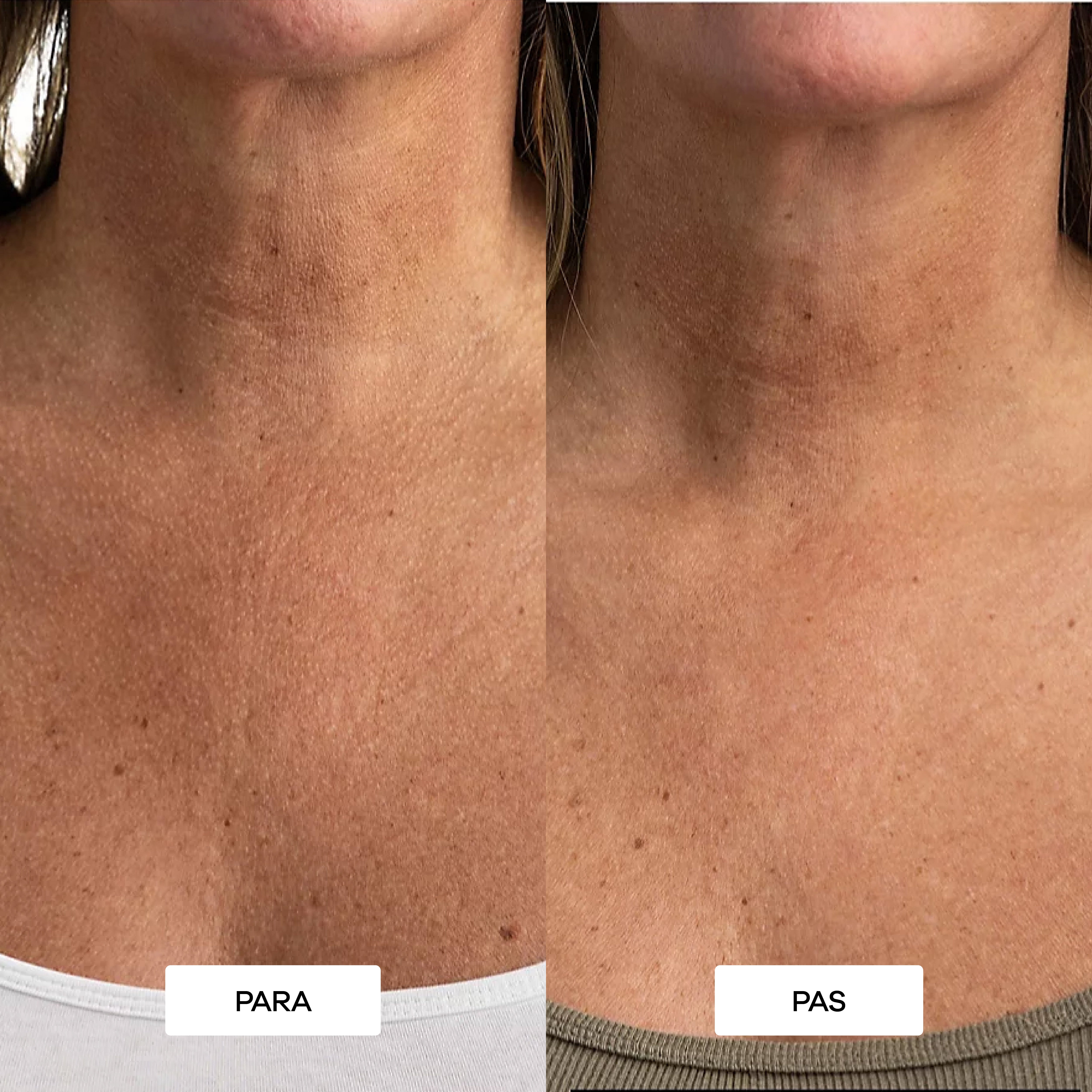 Glowpro Led Mask + Neck: Gen2